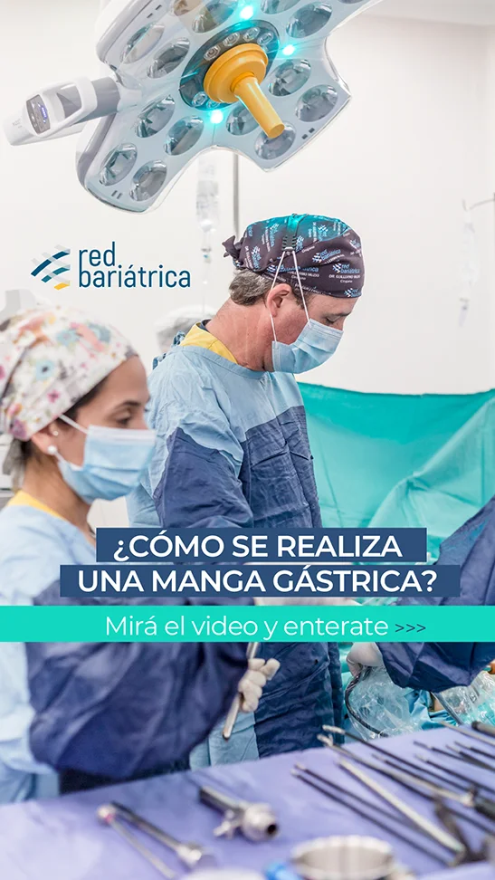 ¿Cómo se realiza una manga gástrica? Mirá el video y enterate